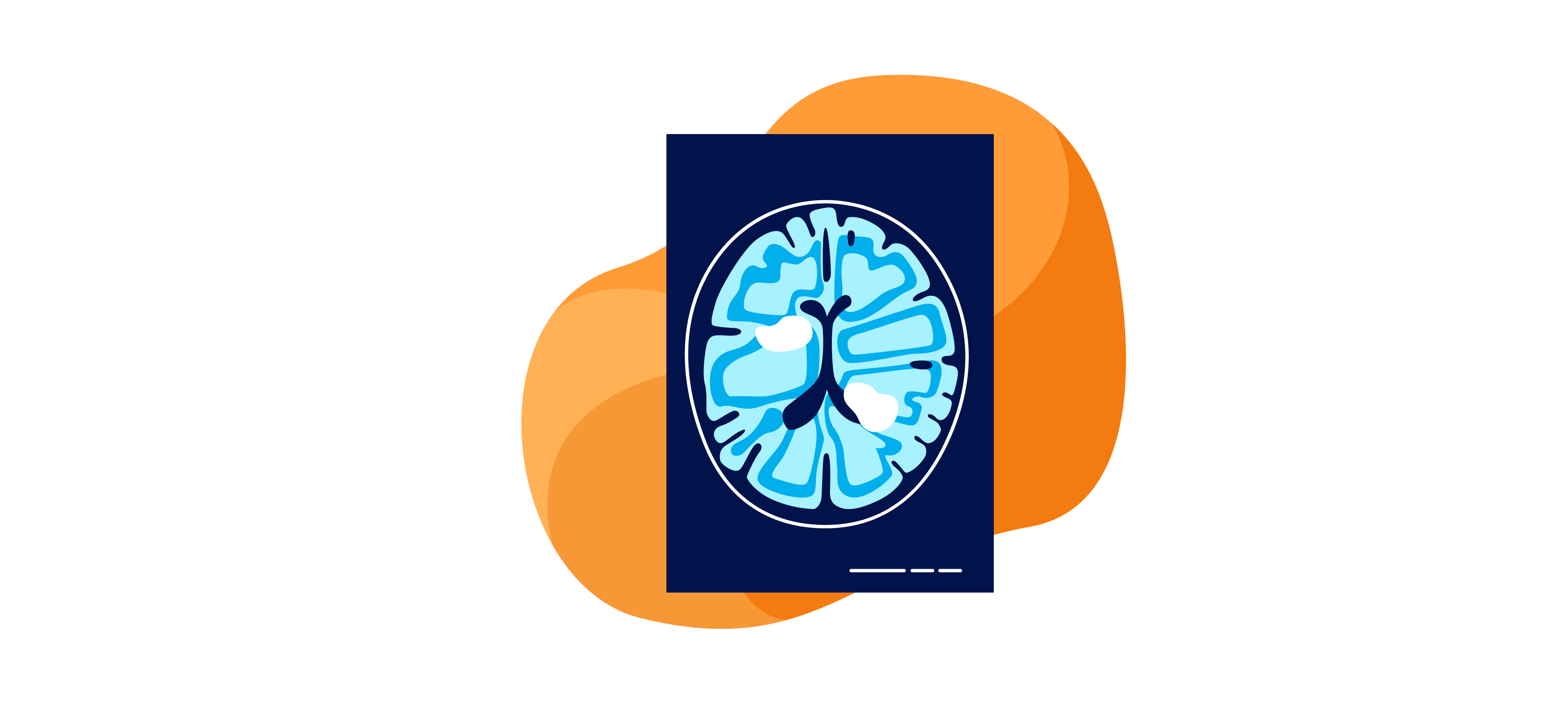 Illustration of an MRI scan