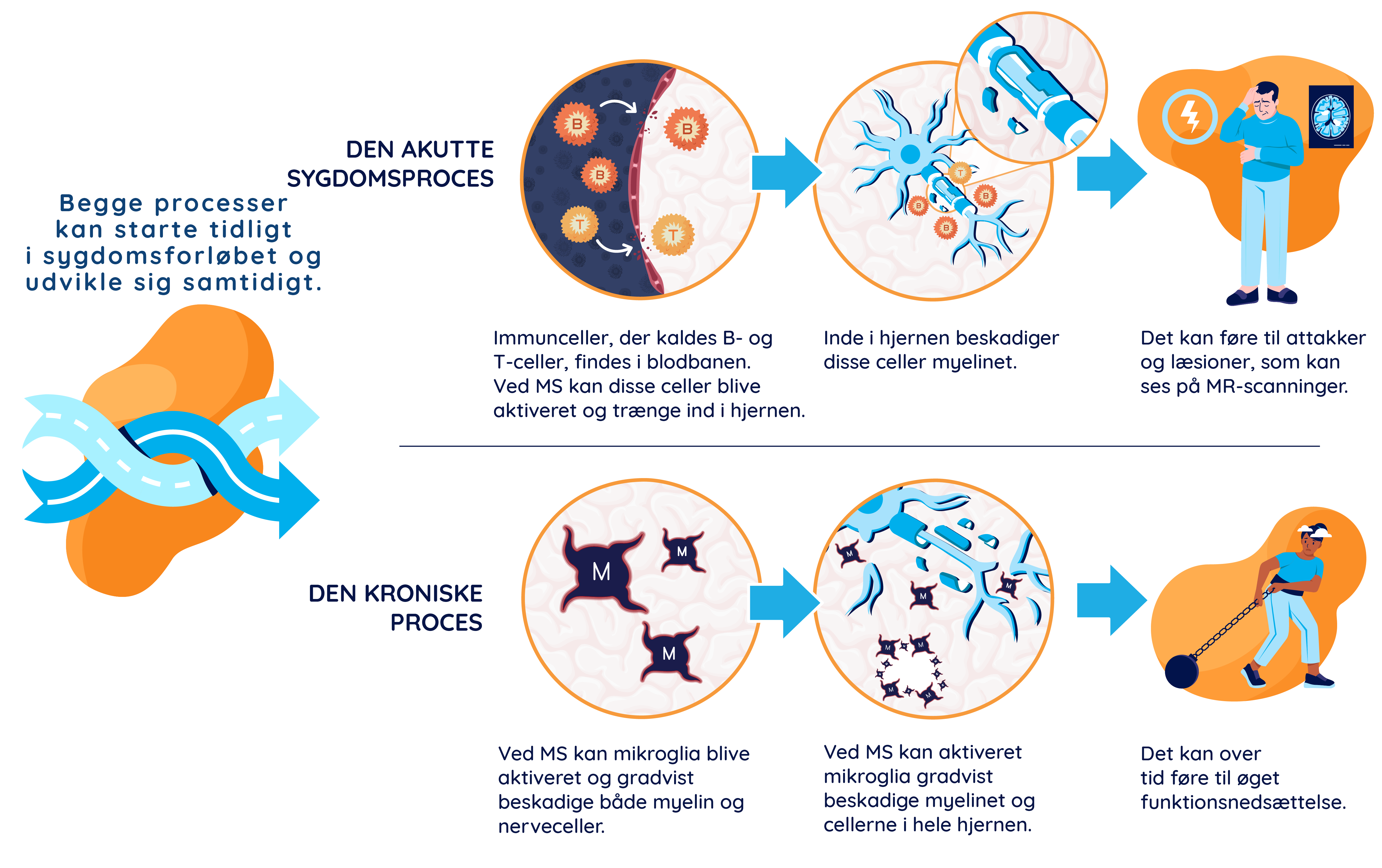 Illustration, der viser den akutte og kroniske proces. Den akutte process, hvor aktiverede B- og T-celler krydser blod-hjerne-barrieren og forårsager tilbagefald og MR-aktivitet, samt den kroniske process, hvor aktiverede mikroglia forårsager sygdomsprogression.
