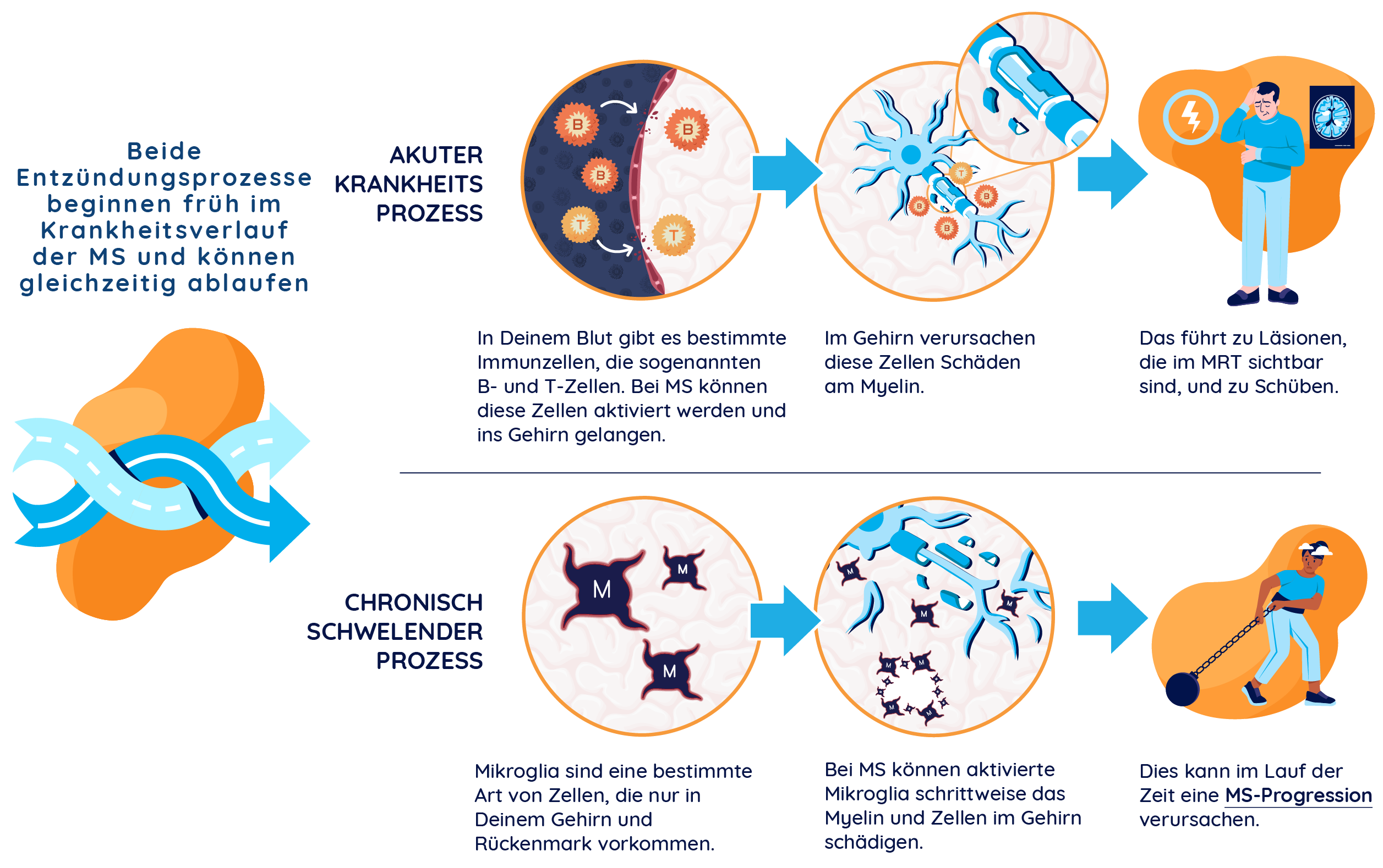 Abbildung, die den akuten und den chronisch schwelenden MS-Prozess darstellt: zeigt den akuten Prozess, bei dem aktivierte B- und T-Zellen die Blut-Hirn-Schranke überwinden und Schübe sowie im MRT sichtbare Veränderungen verursachen, und den chronisch schwelenden Prozess, der durch aktivierte Mikroglia zunehmende Einschränkungen verursacht