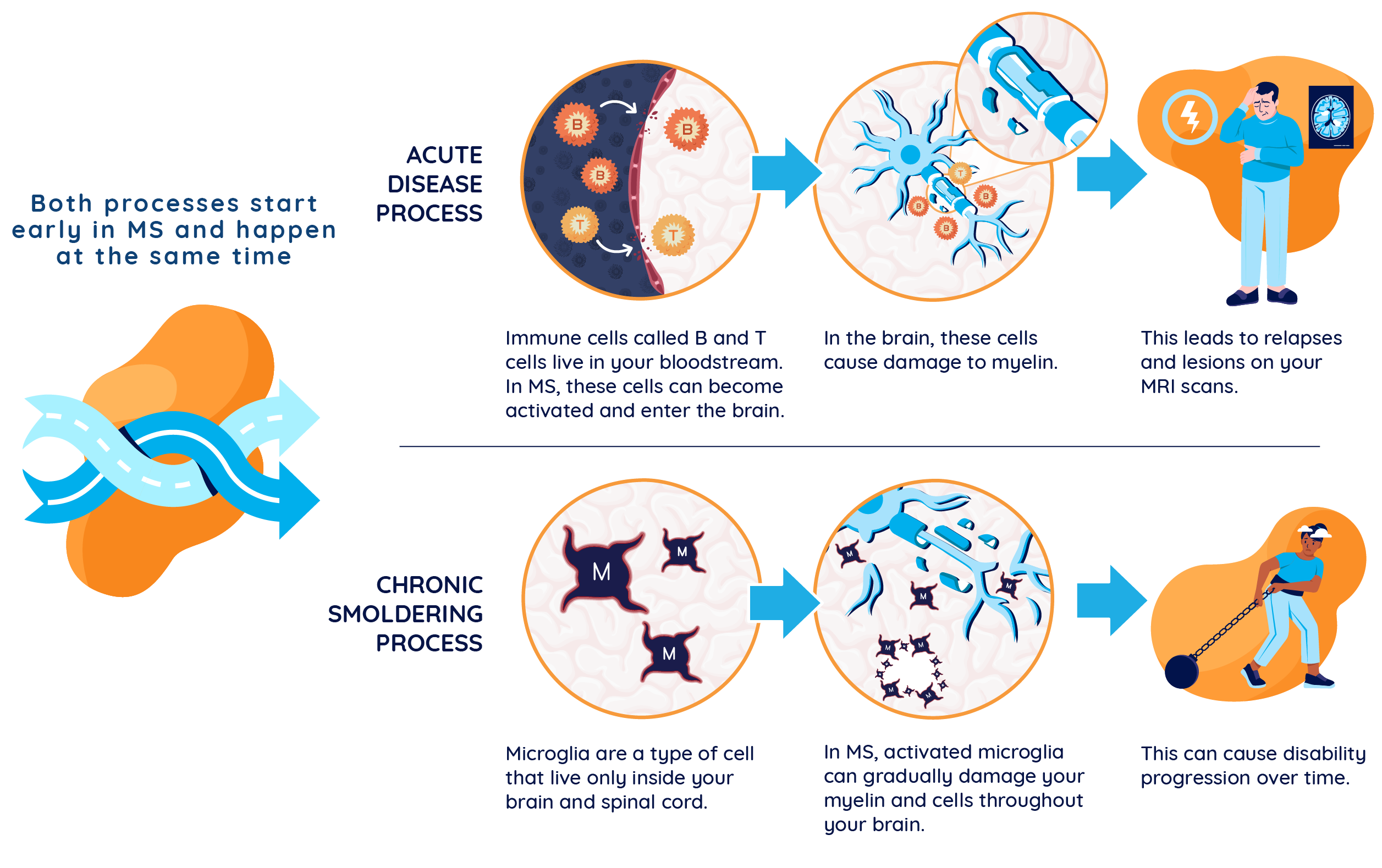 “Illustration showing acute and chronic smoldering MS processes: shows the acute process of activated B and T cells crossing the blood brain barrier, causing relapses and MRI activity, and the chronic smoldering process of activated microglia causing disability progression