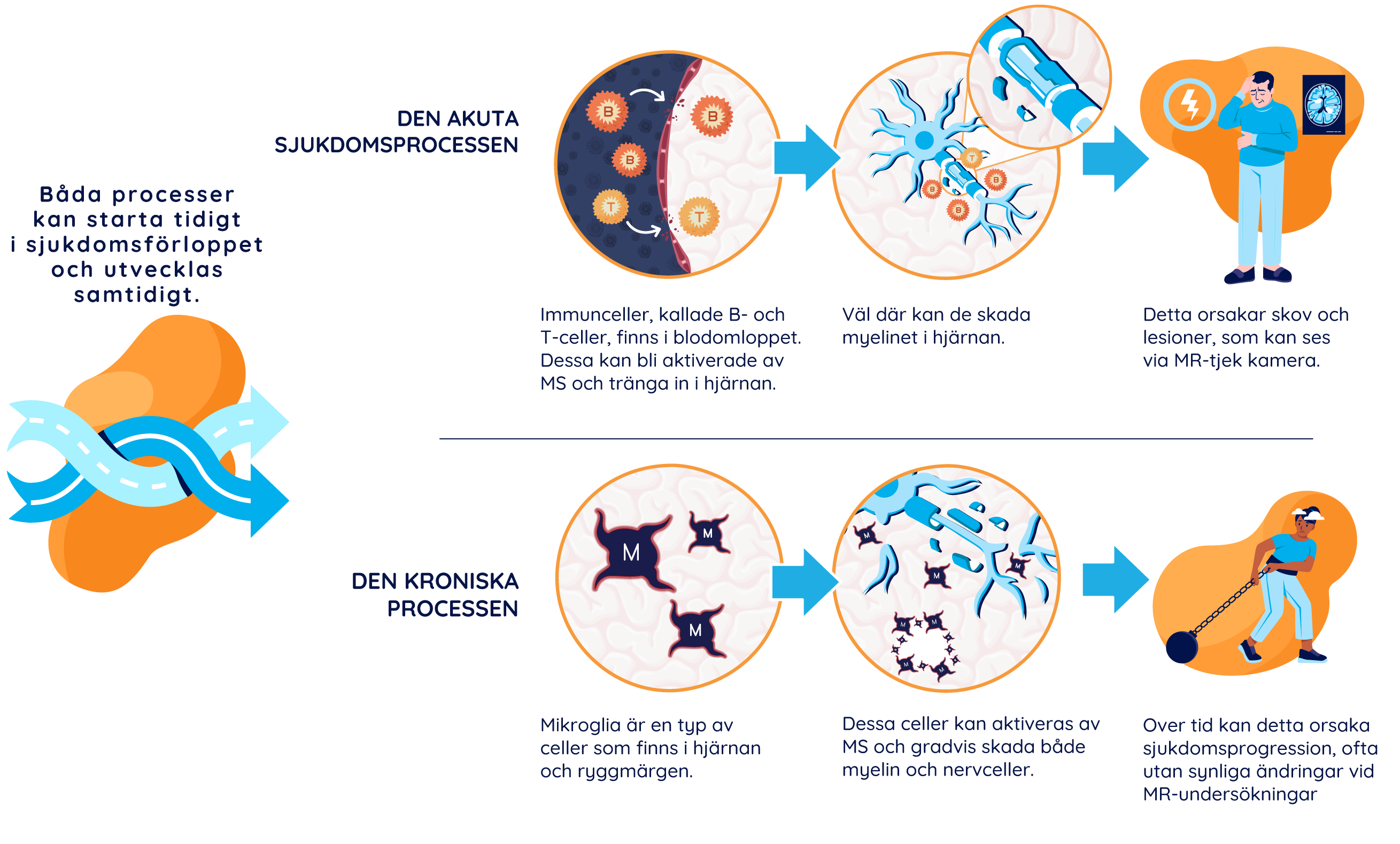 Illustration som visar akuta och kroniska smygande MS-processer: visar den akuta processen där aktiverade B- och T-celler passerar blod-hjärnbarriären, vilket orsakar återfall och MRI-aktivitet, samt den kroniska smygande processen där aktiverade mikroglia orsakar funktionsnedsättning.