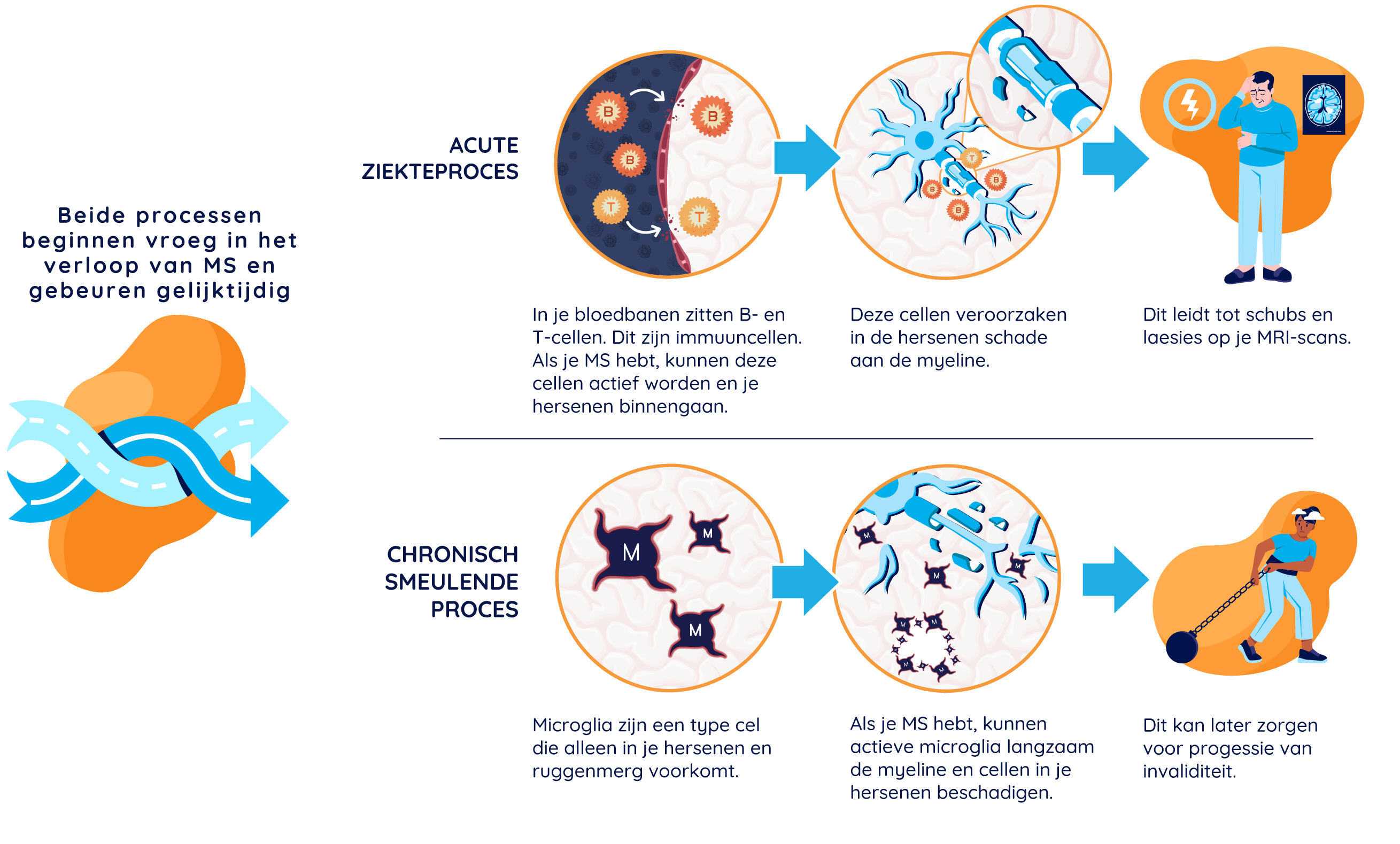 Illustratie die acute en chronische sluimerende MS-processen toont: toont het acute proces waarbij geactiveerde B- en T-cellen de bloed-hersenbarrière passeren en terugval en MRI-activiteit veroorzaken, evenals het chronische proces waarbij geactiveerde microglia progressie van invaliditeit veroorzaken.
